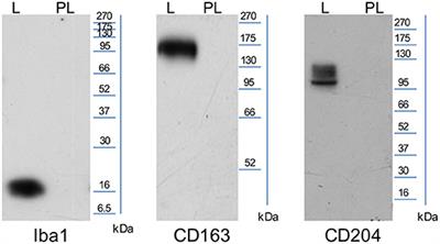 Tumor-Associated Macrophages in Canine Oral and Cutaneous Melanomas and Melanocytomas: Phenotypic and Prognostic Assessment